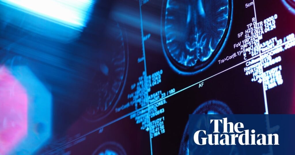 El estudio vincula una mayor desigualdad a los cambios estructurales en los cerebros de los niños | Investigación médica