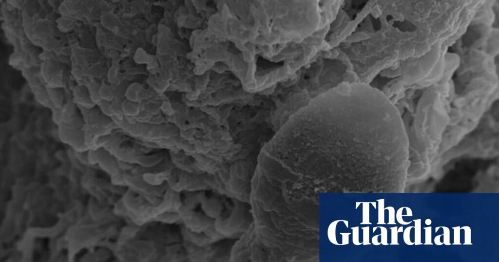 Los espermatozoides se pierden en el espacio, sugiere una investigación australiana sobre los impactos de la microgravedad | Espacio Los espermatozoides se pierden en el espacio, sugiere una investigación australiana sobre los impactos de la microgravedad | Espacio