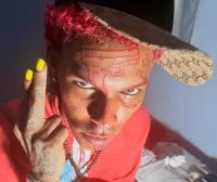 Dilon Baby se tatua una pistola en la frente (imágenes) Dilon Baby se tatua una pistola en la frente (imágenes)