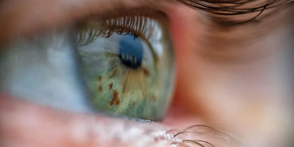 Un dispositivo que revive globos oculares de donantes muertos podría hacer posibles los trasplantes de ojos Un dispositivo que revive globos oculares de donantes muertos podría hacer posibles los trasplantes de ojos